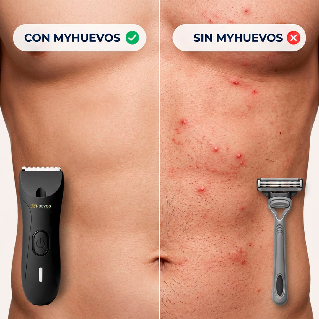 Rasuradora Íntima MyHUEVOS® 4.0
