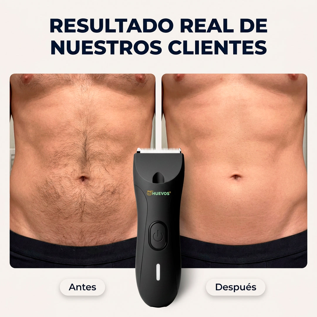 Rasuradora Íntima MyHUEVOS® 4.0