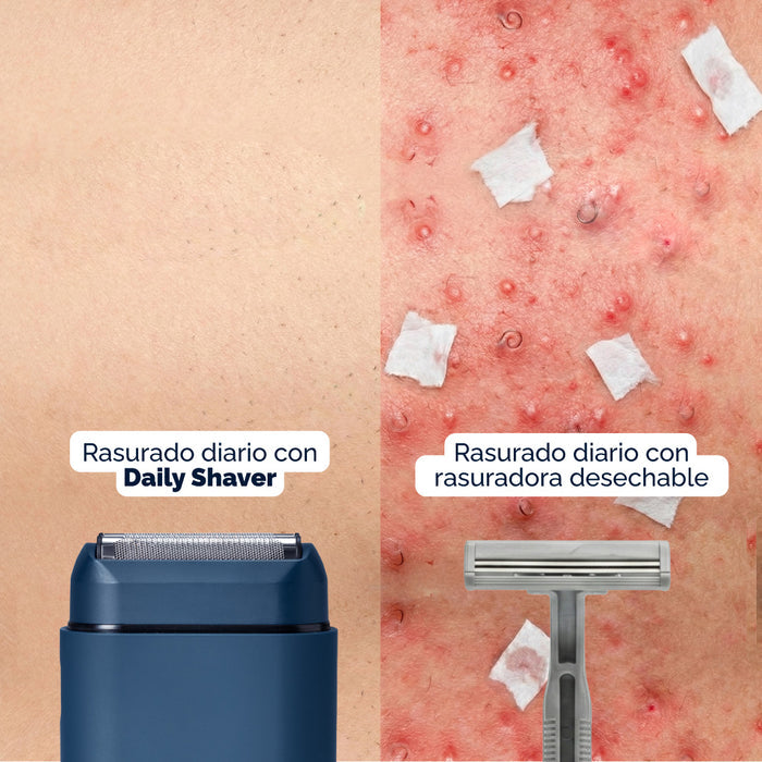 Rasuradora Facial Daily Shaver MyHuevos®